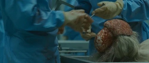 Pathology