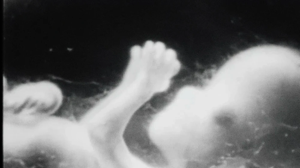 Still frame 15 from bbno$ - why am i like this (2026) directed by Shiraz